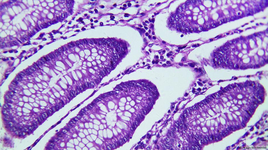 cancer-cells.jpg (113 KB)