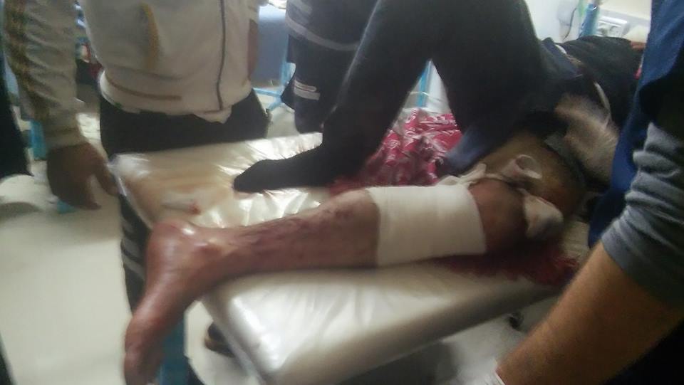 26730597_1095165527291711_3328283513050045229_n.jpg (44 KB)